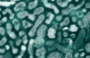 microscope_h5n1virus microscope_h5n1virus