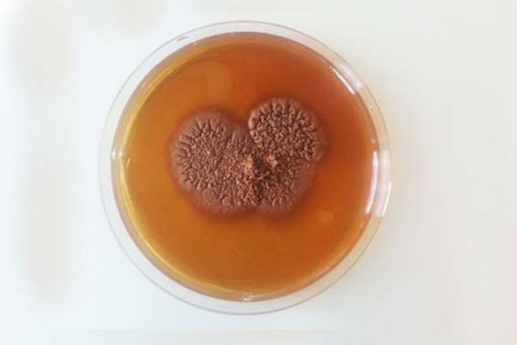 Mycetoma laboratory analysis Mycetoma laboratory analysis