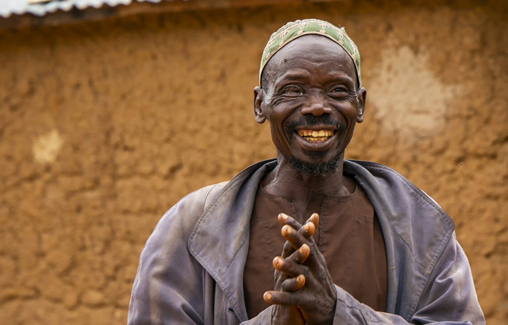 Eye sight Trachoma آدو، المزارع البنيني عاد مرة أخرى قادراً على رعاية حيواناته