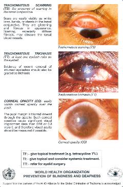Trachoma-simplified-grading-card-verso-Eng