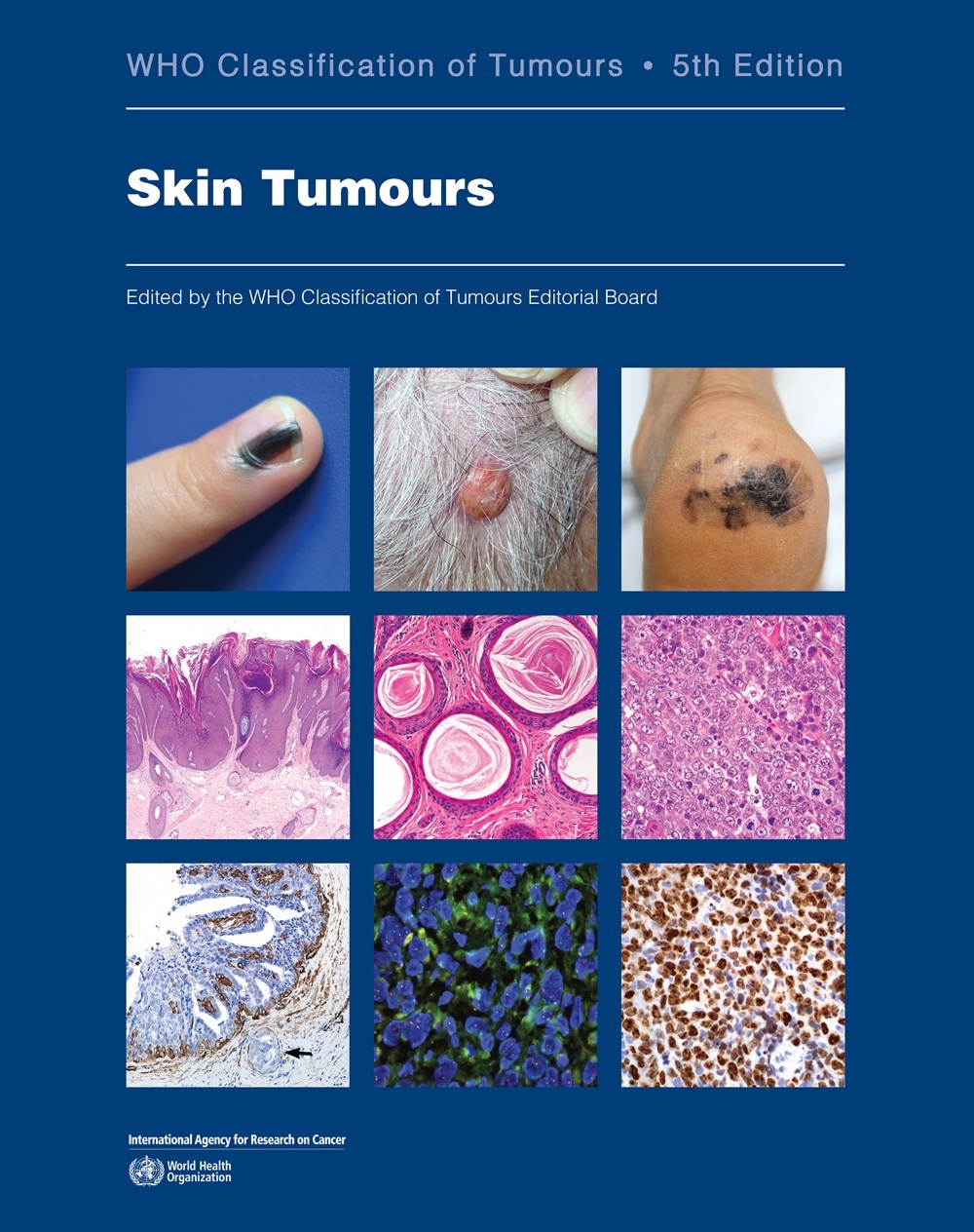 WHO Classification of Skin Tumours, 5th edition-thumbnail WHO Classification of Skin Tumours, 5th edition-thumbnail