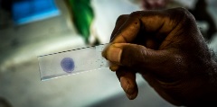 Vaccination research Vaccination research